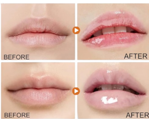 Lip Lightening for Dark Lips,