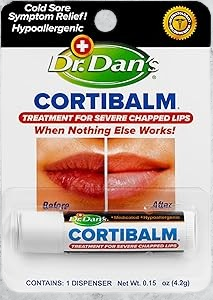 Lip Balm