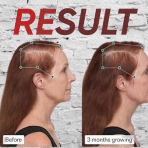 product for hair growth fast